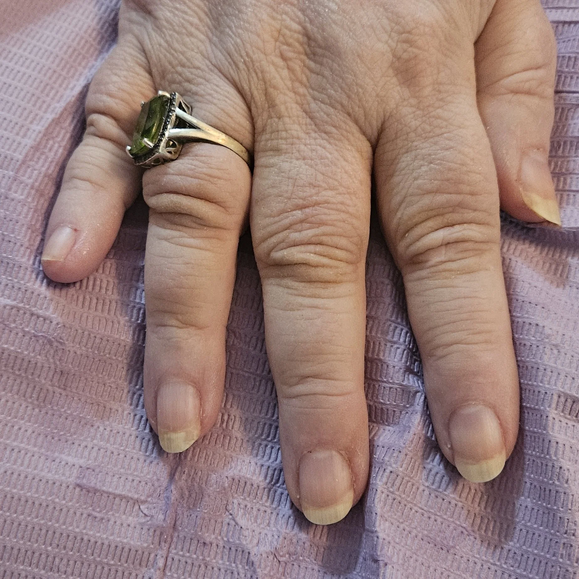 Senior Nail Trim-After