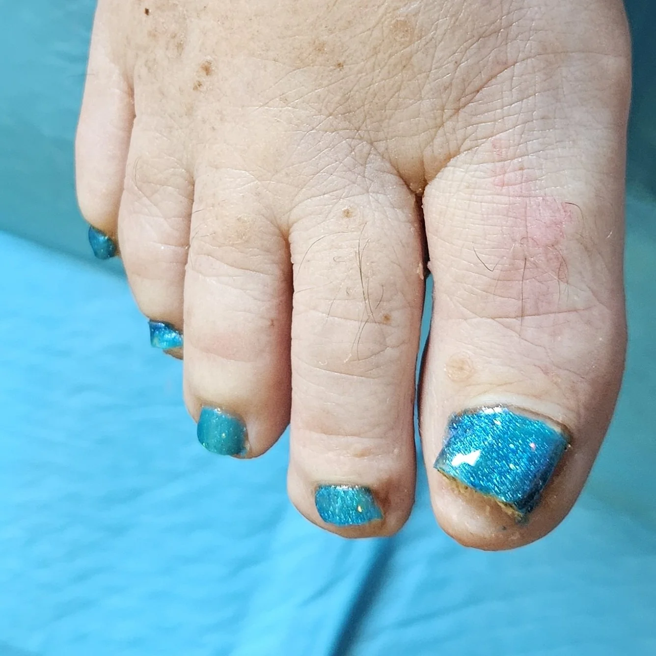 Waterless Pedicure with Polish-After