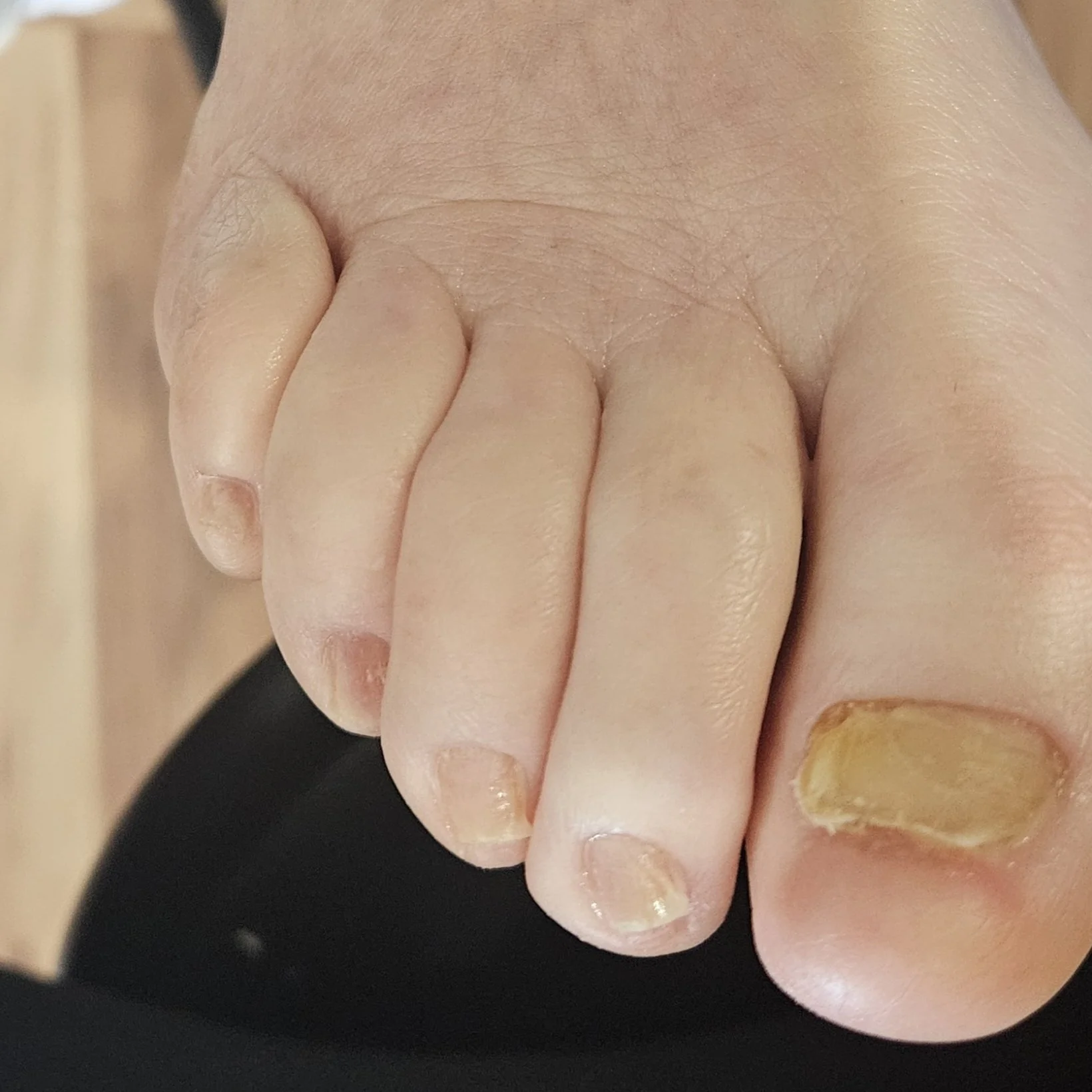 Senior Nail Trim-After