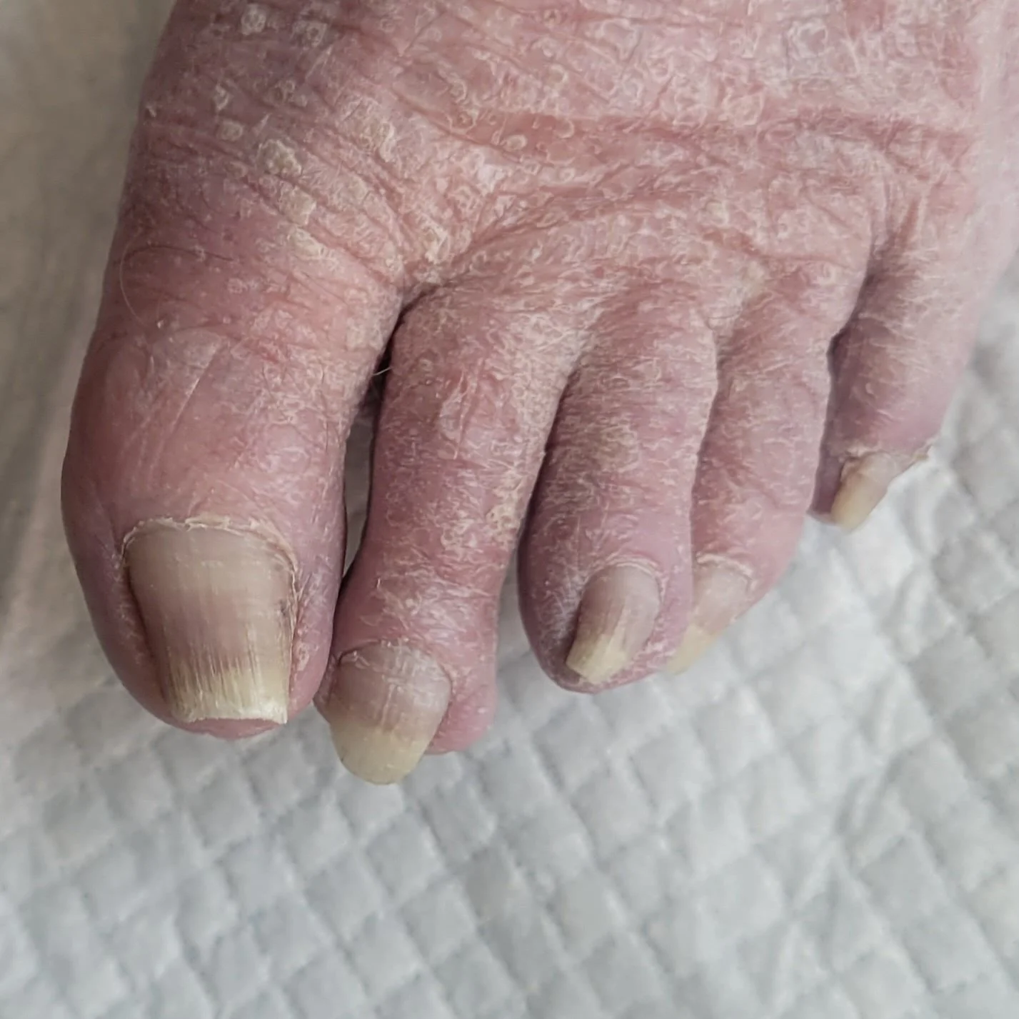 Senior Nail Trim-Before