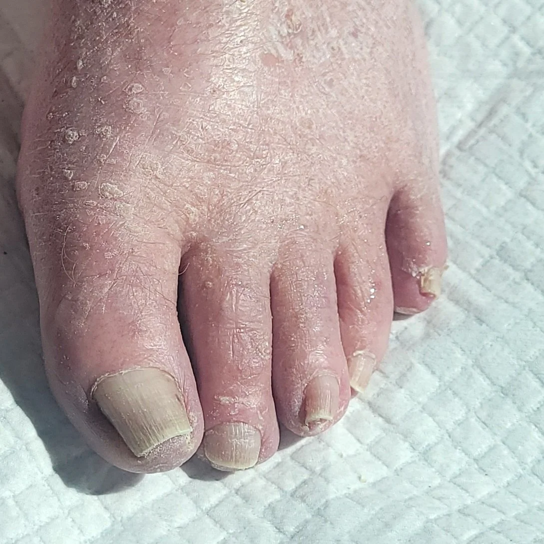 Senior Nail Trim-After