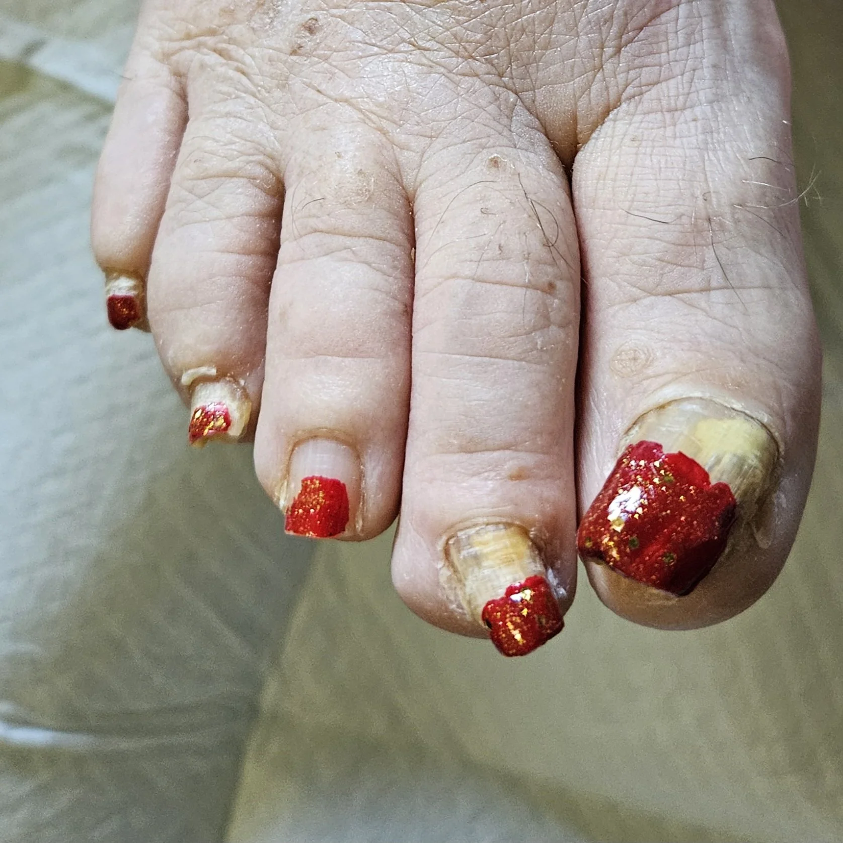 Waterless Pedicure with Polish-Before