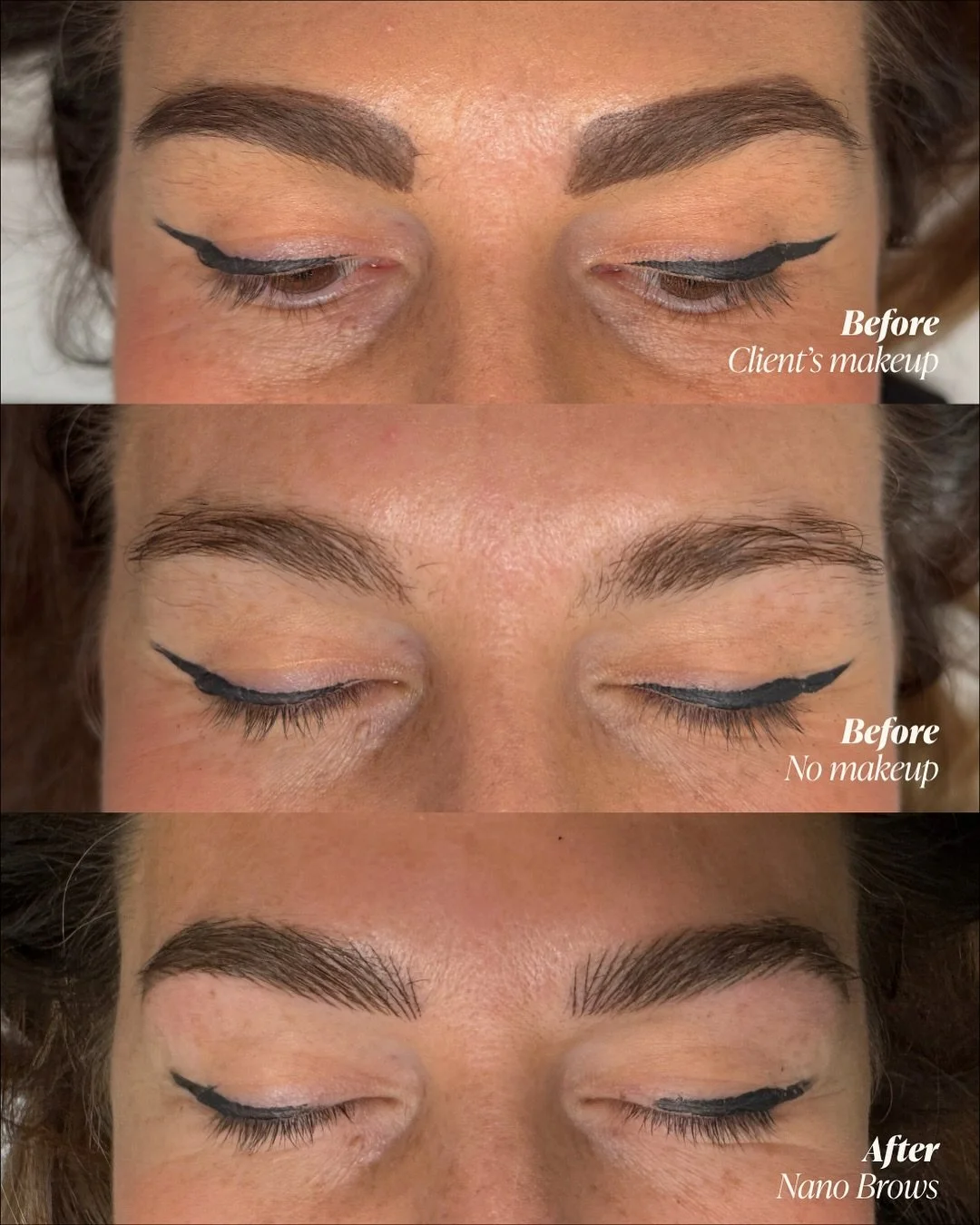 Full + fluffy combination brows ☁️✨ Want to ditch the brow makeup and wake up to these brows every day? My client Virginia felt the same!

My client has lovely full brows naturally, but she wanted to ditch the brow pencil every day. We discussed the 