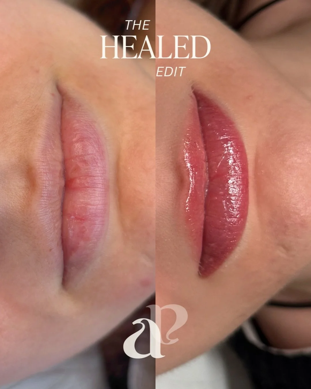 HEALED lip blush 🌸🌷🎀🩷 Warm pinky tones to bring these lips to life! Adding more definition really shows off their lovely natural shape&hellip;

These healed lips are 6 months after the initial treatment &amp; touch up (my client came back for bro