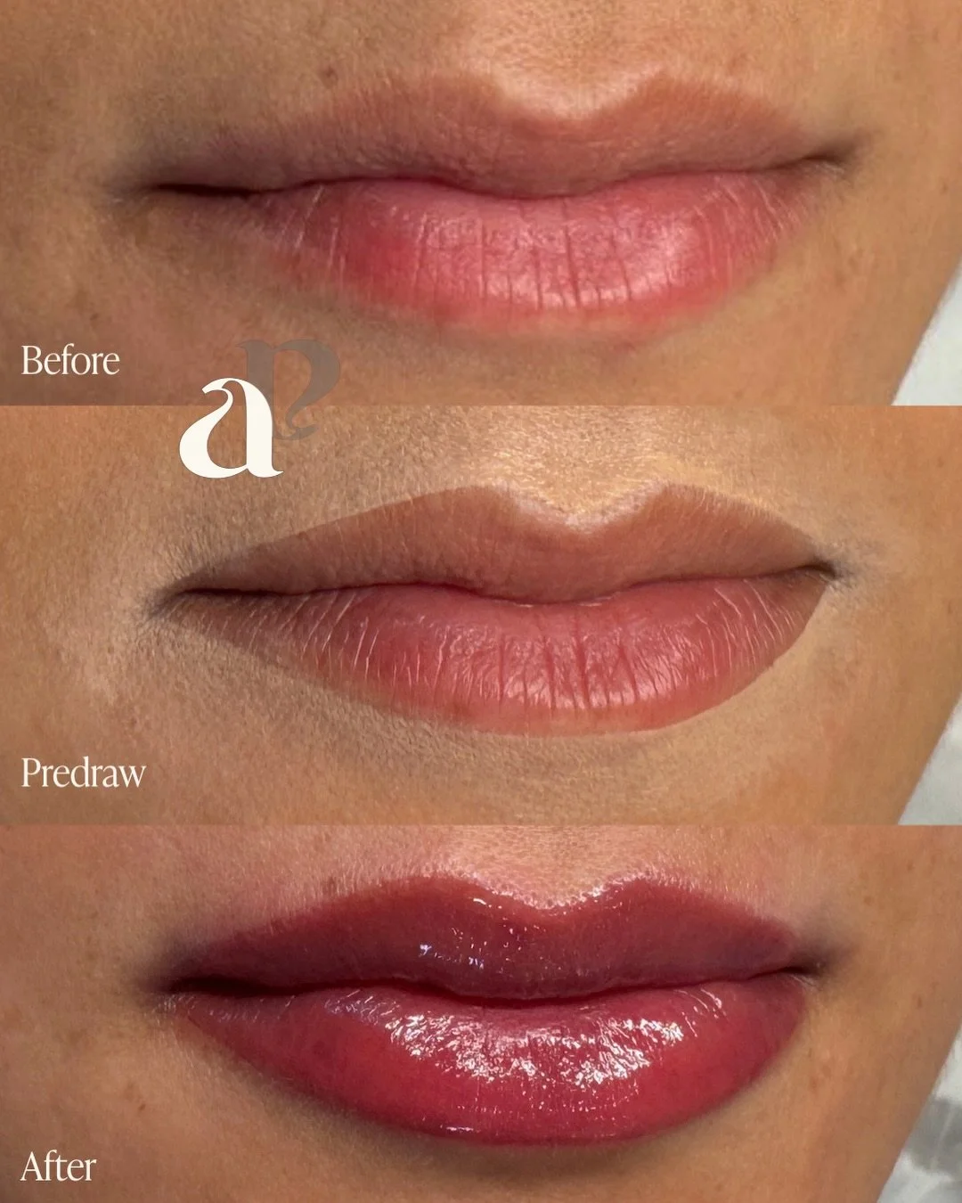 Hues of mauve for these M shaped lips 🍇💜🪻✨

M shaped lips are when the lips have a more prominent, full centre in the top lip, compared to the outer lip 👄 

I get asked a lot: &ldquo;Can I have lip blush if I have m shaped lips?&rdquo;

The answe