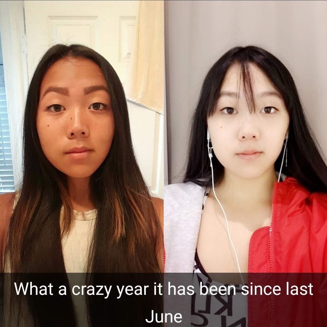 Quinn Lin’s before-and-after photos when she took the glutathione drip. Courtesy of Quinn Lin