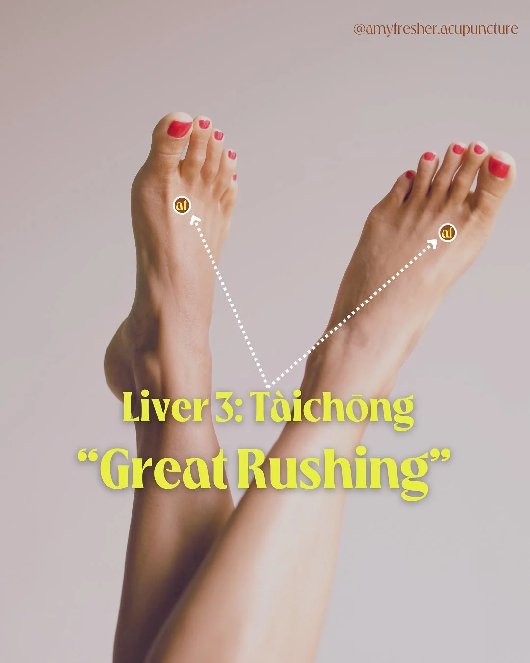 🌿 Liver 3 &ldquo;Taichong&rdquo; &ndash; The Great Rushing 🌿

Spring is a season of renewal, growth, and fresh energy&mdash;but it can also bring tension, stress, and a sense of stagnation. Liver 3 is the perfect acupuncture point to help you trans