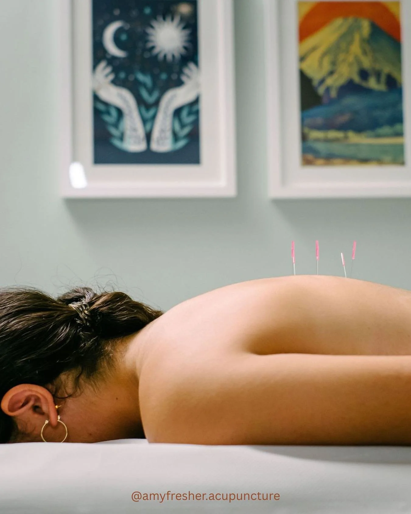 ✨ Experience Acupuncture in the comfort of your own home.

Relax. Restore. Reconnect.

📍 Home Visits Across South West London
💆&zwj;♀️ Specialist care in Women&rsquo;s health &bull; Fertility &amp; Pregnancy
😌 Support for Stress, Chronic Condition