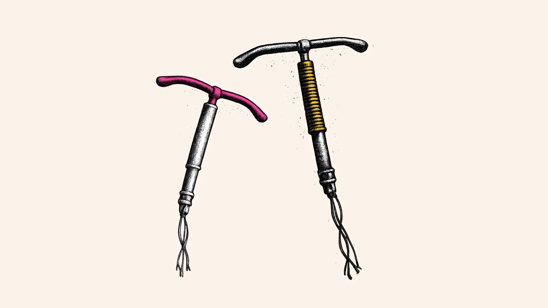 Which IUD Is Right for Me? Comparing IUD Options