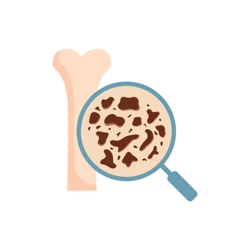 Understanding Osteopenia vs Osteoporosis