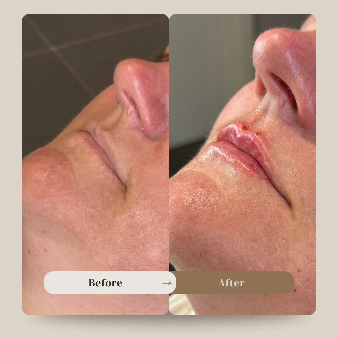 Copy of Beige Minimalist Skincare Before and After Instagram Post.png