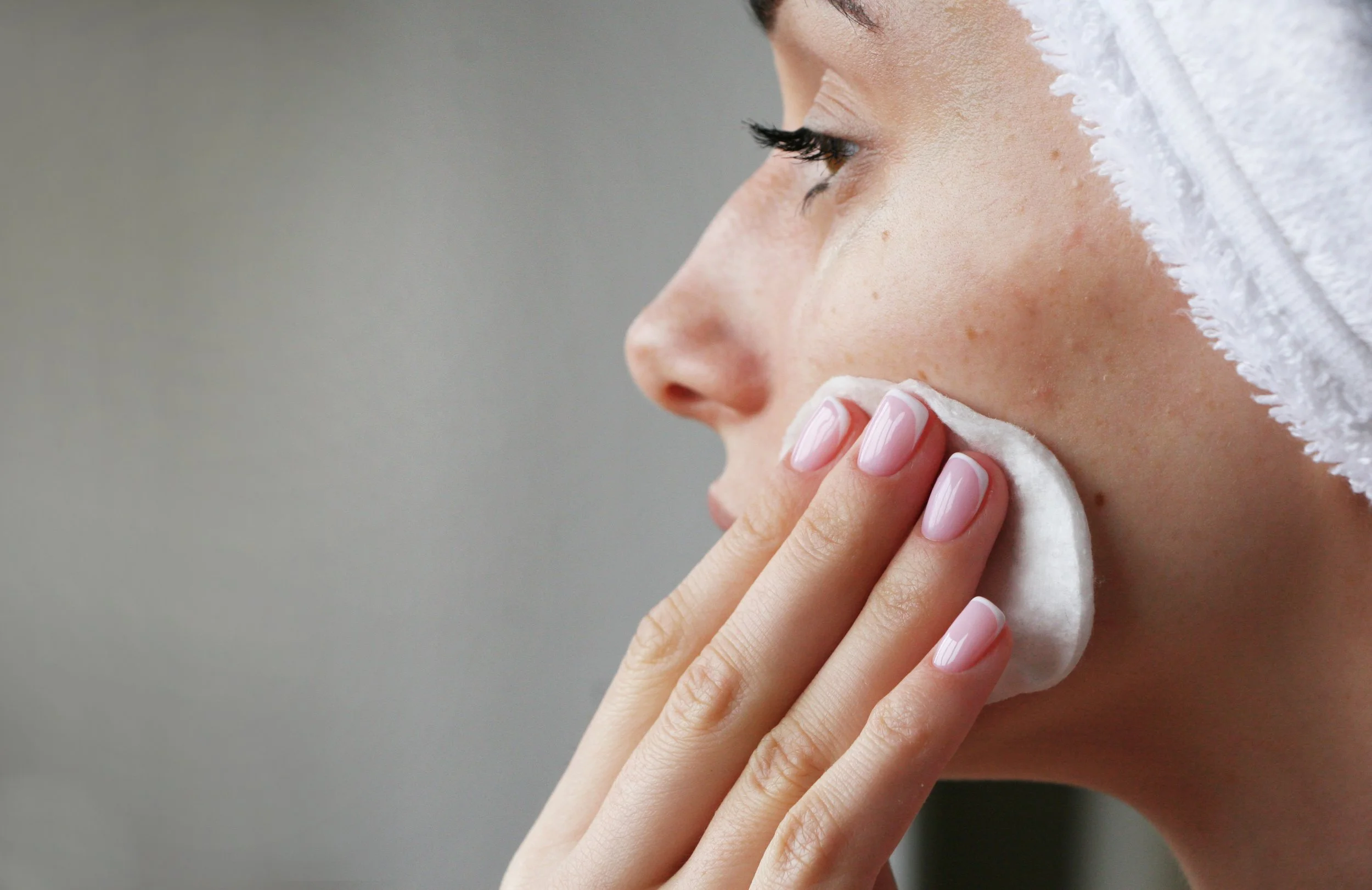 Why Your Acne Keeps Coming Back Despite Good Skincare, And How Chemical Peels Can Help