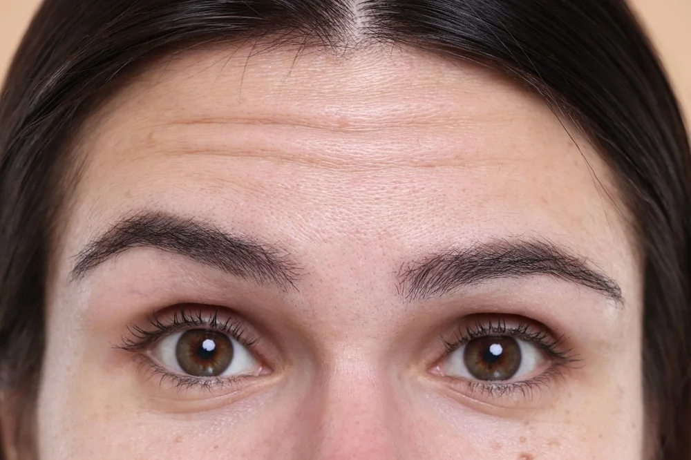 Fine lines & wrinkles