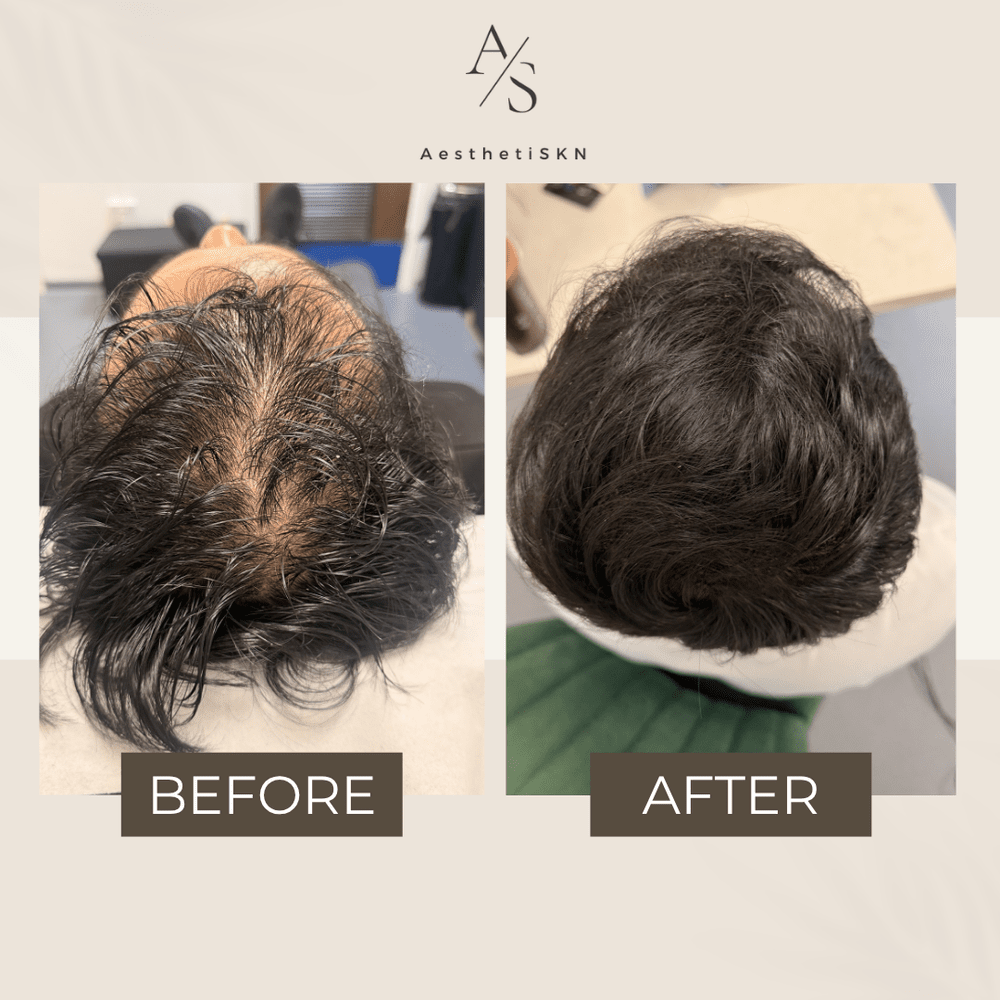 Hair rejuvenation