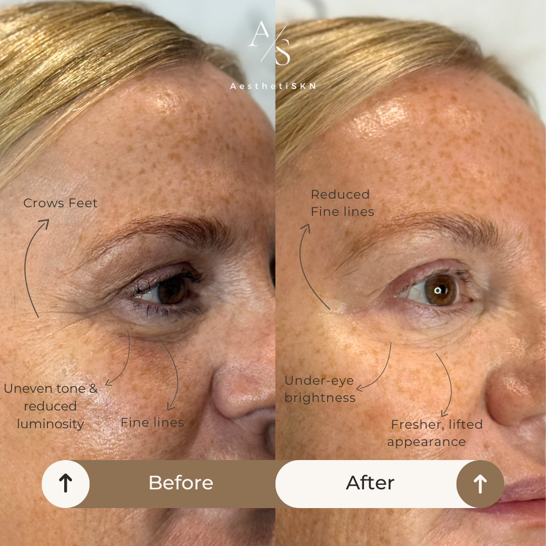 eye rejuvenation polynucleotides
