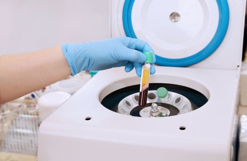 PRP Therapy at AesthetiSKN