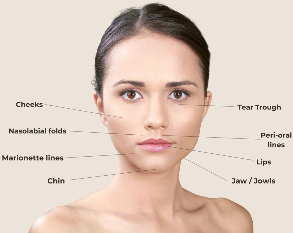 Facial areas treated for volume restoration