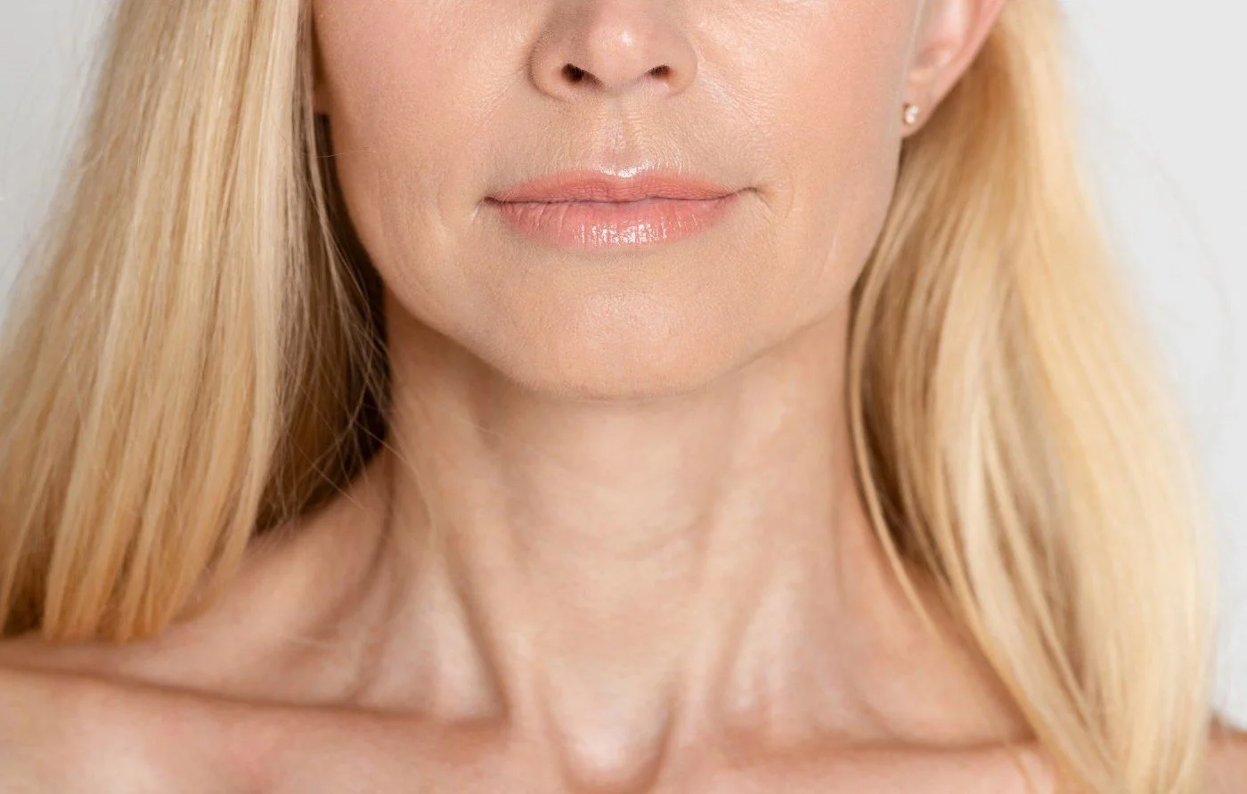 platysma_bands_nefertiti_neck_lift.jpg