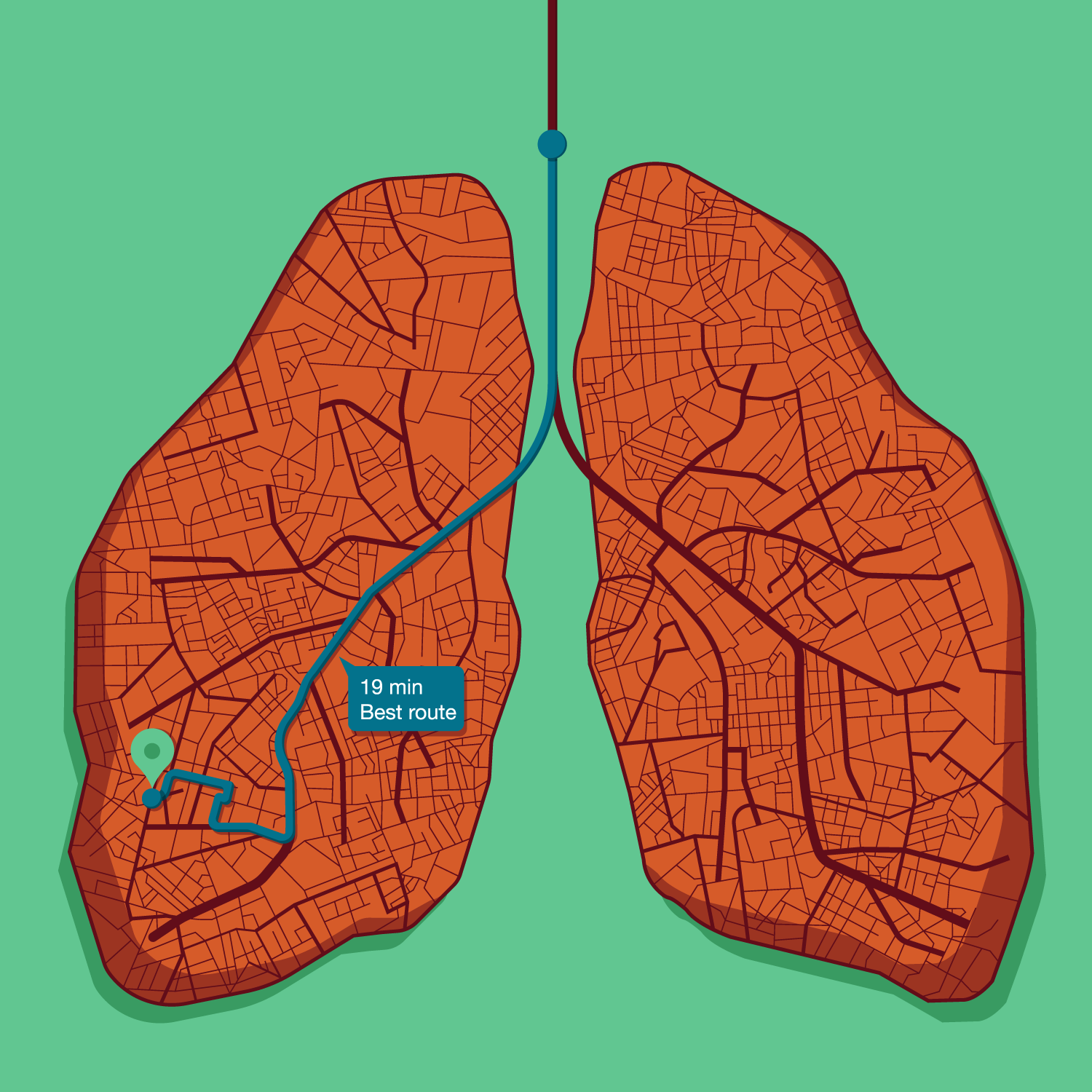  
 Case Notes 
 Ion Robotic Assisted Lung Biopsy 
 