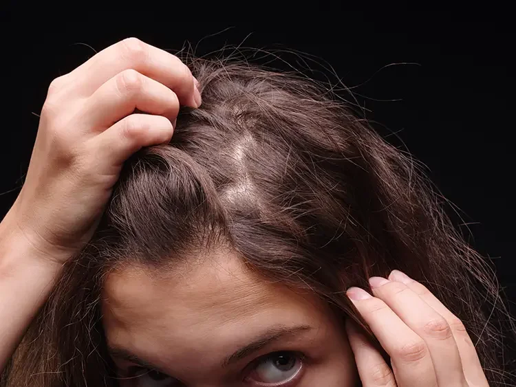 How to Stop Hair Pulling and Skin Picking at Home