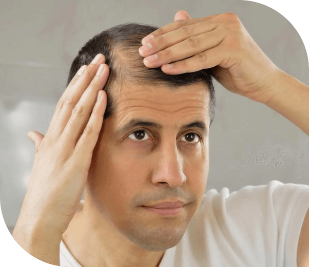 What Is Habit Reversal Training for Hair Pulling and Skin Picking? And Does It Work?
