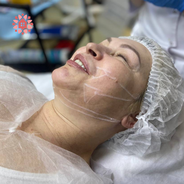 VICTORIA PDO Thread lift training in New York by Aesthetic Power House