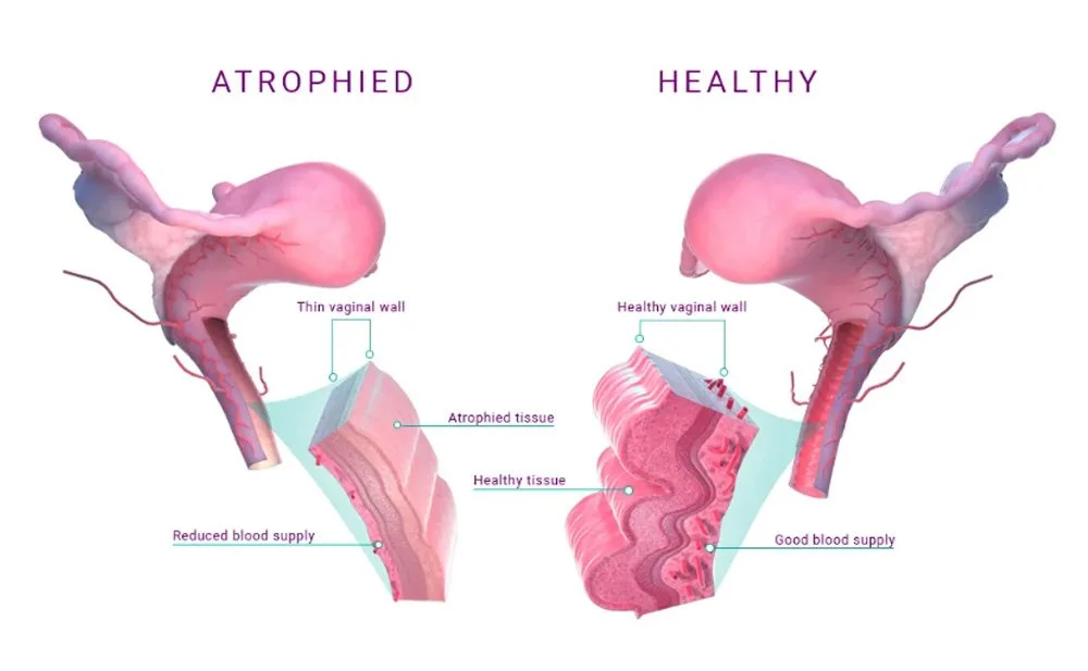 Aveta Medical