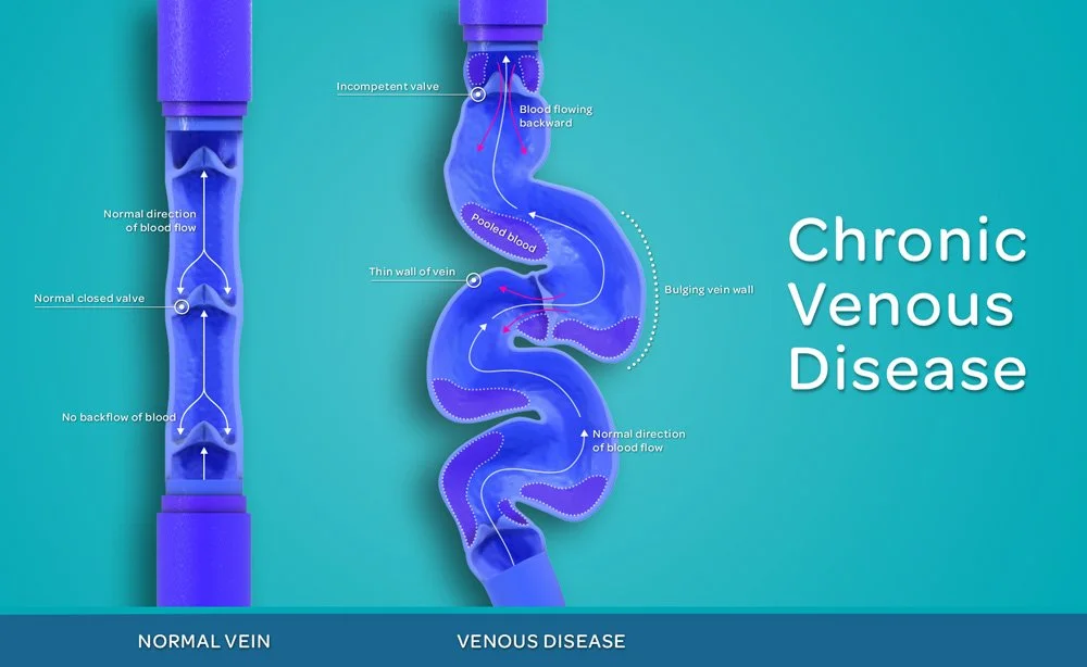 InVera Medical