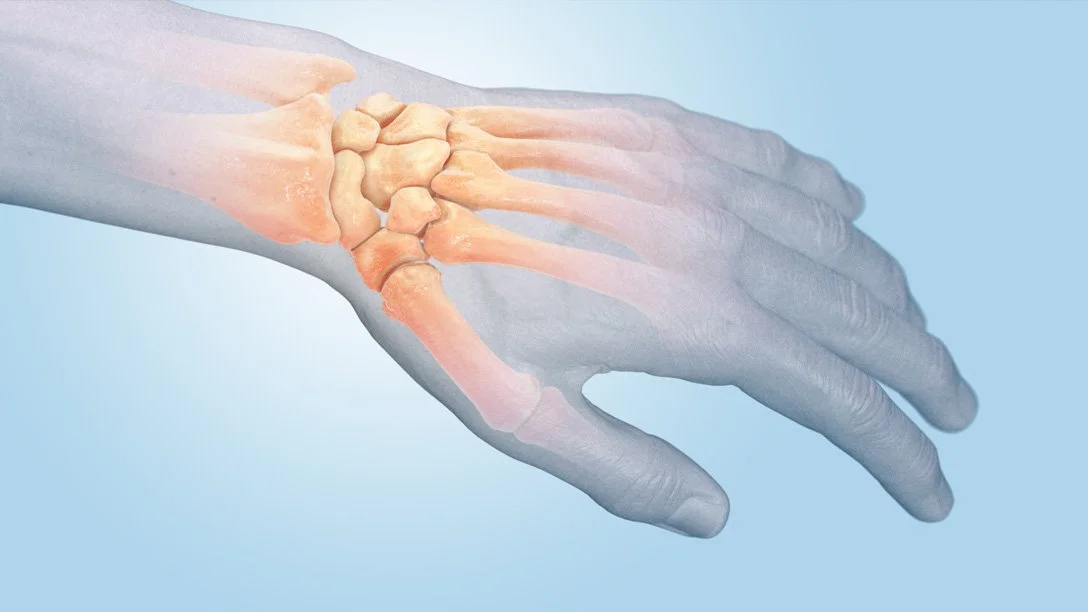 Medical illustration of a human hand showing bones, with a focus on wrist joint