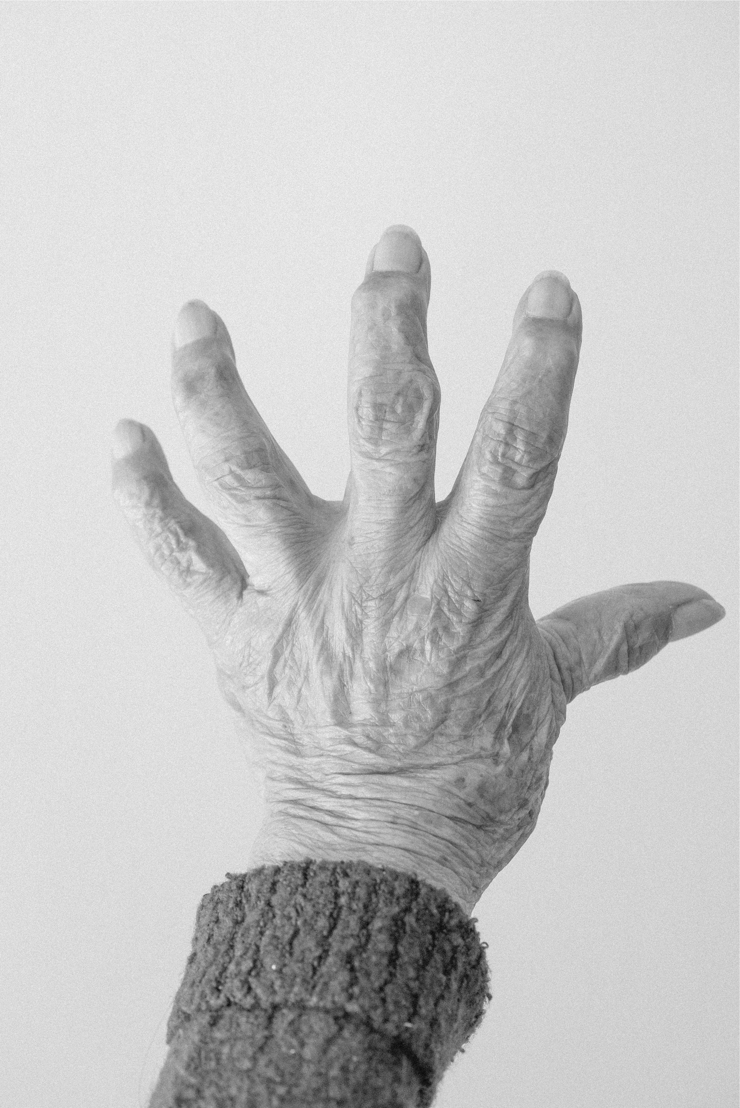 Arthritic Hand, Lymphatic Drainage, Lymphatic Drainage for Arthritis, Reduce inflammation, Chronic inflammation, Lymphatic drainage for chronic inflammation