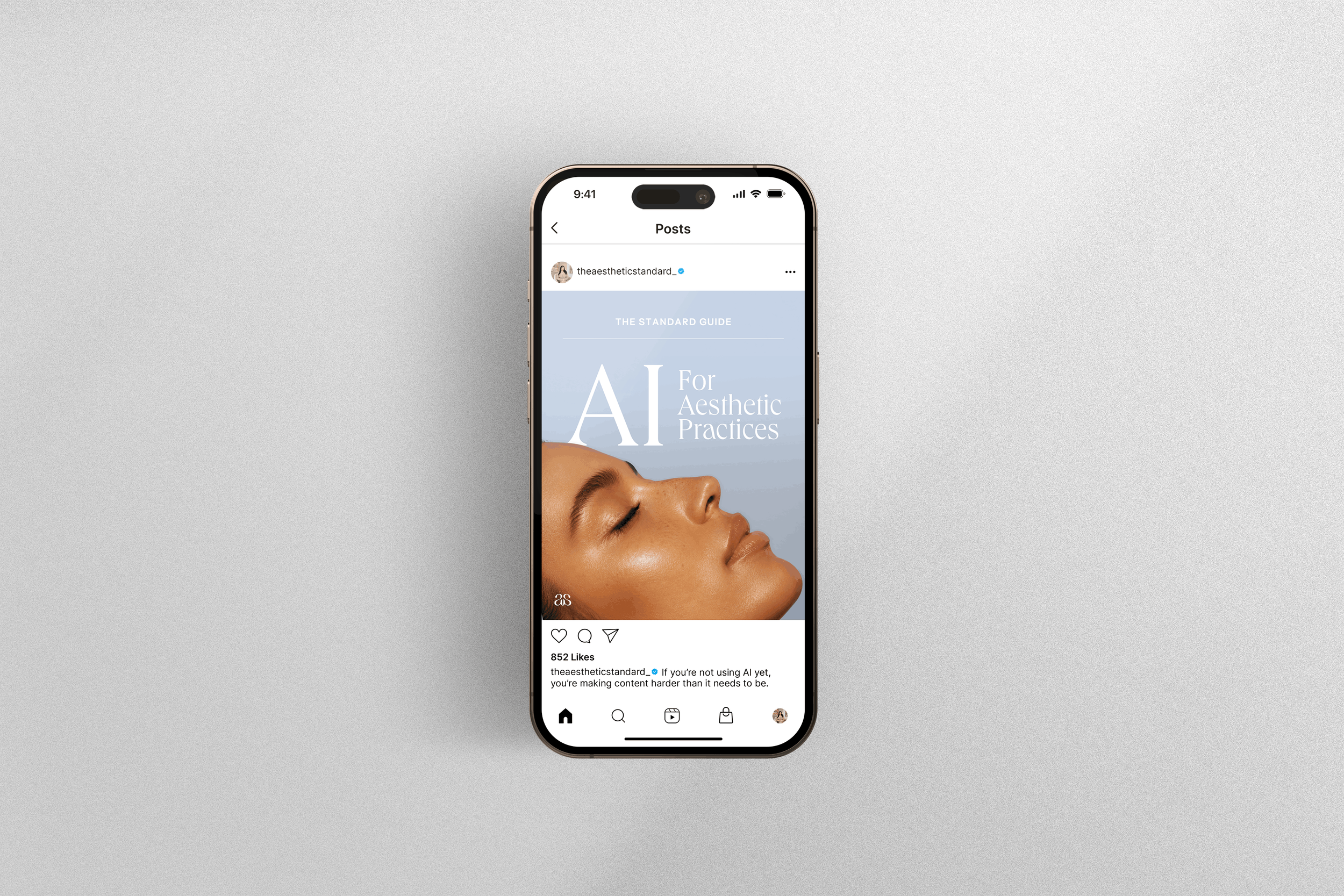an iphone with a social media template for med spas