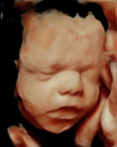 Peek A Boo 3D 4D Ultrasound