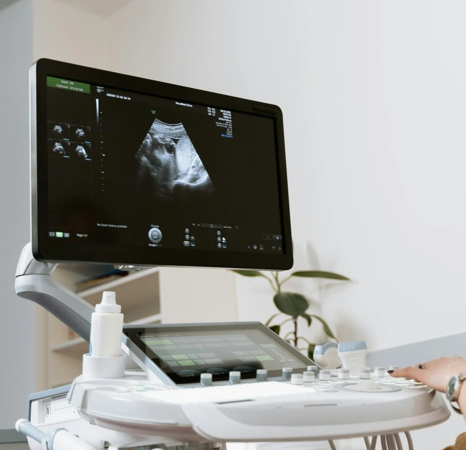 Peek A Boo 3D 4D Ultrasound