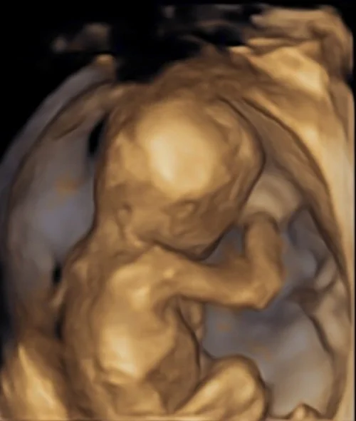 Pregnancy Ultrasounds and Extras — Peek A Boo 3D 4D Ultrasound