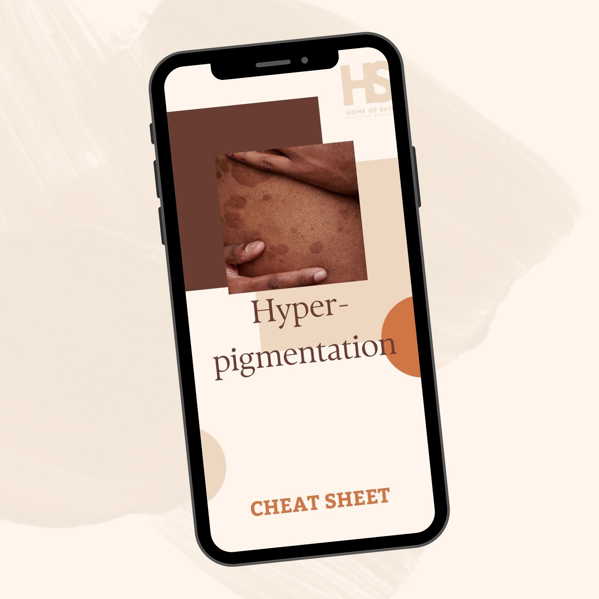 Understanding Hyperpigmentation: A Cheat Sheet