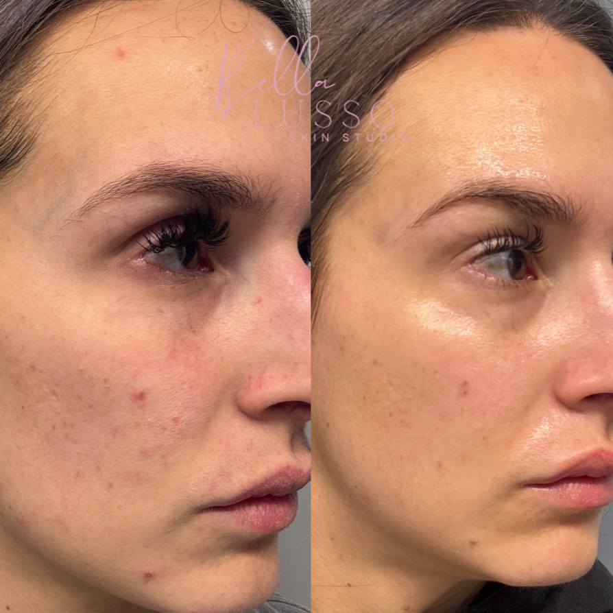 after+treatment.png