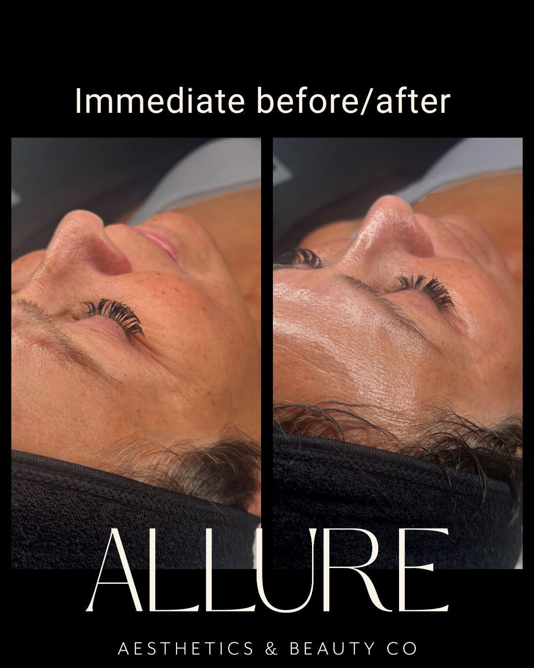Biorepeel fall reset - 6.png