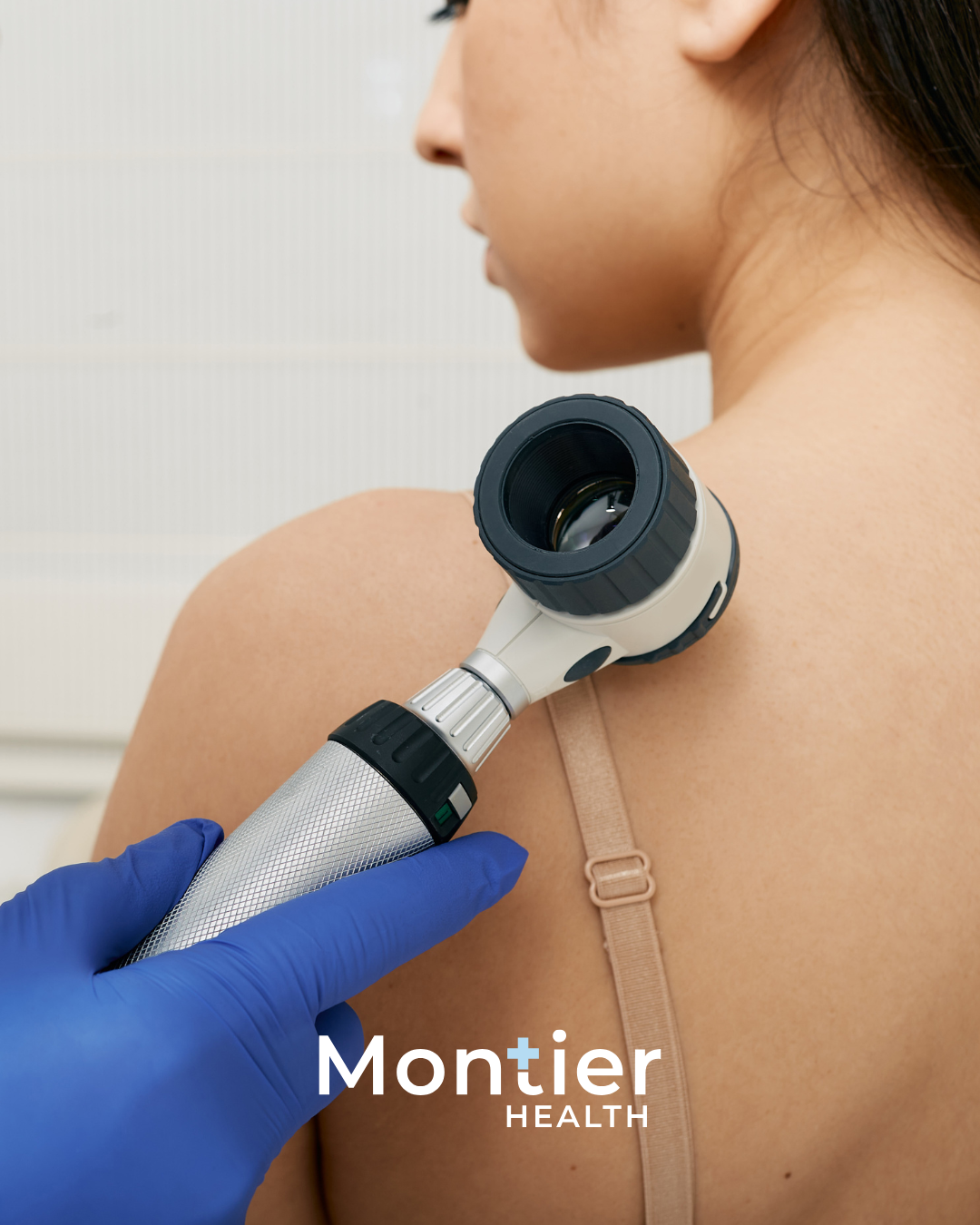 Skin check Australia mole cancer awareness