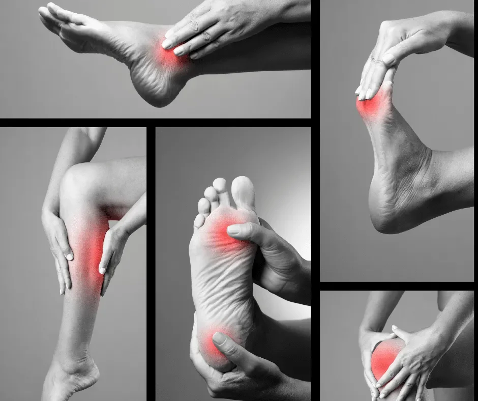 Multiple human feet and legs with red highlights indicating pain or discomfort, including the heel, ankle, knee, and other areas.