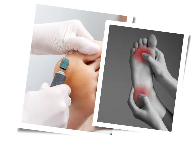 Close-up of a medical professional using a laser device on a patient's foot during a podiatric treatment, with an inset of a black and white image showing a foot with areas of redness indicating pain or inflammation.