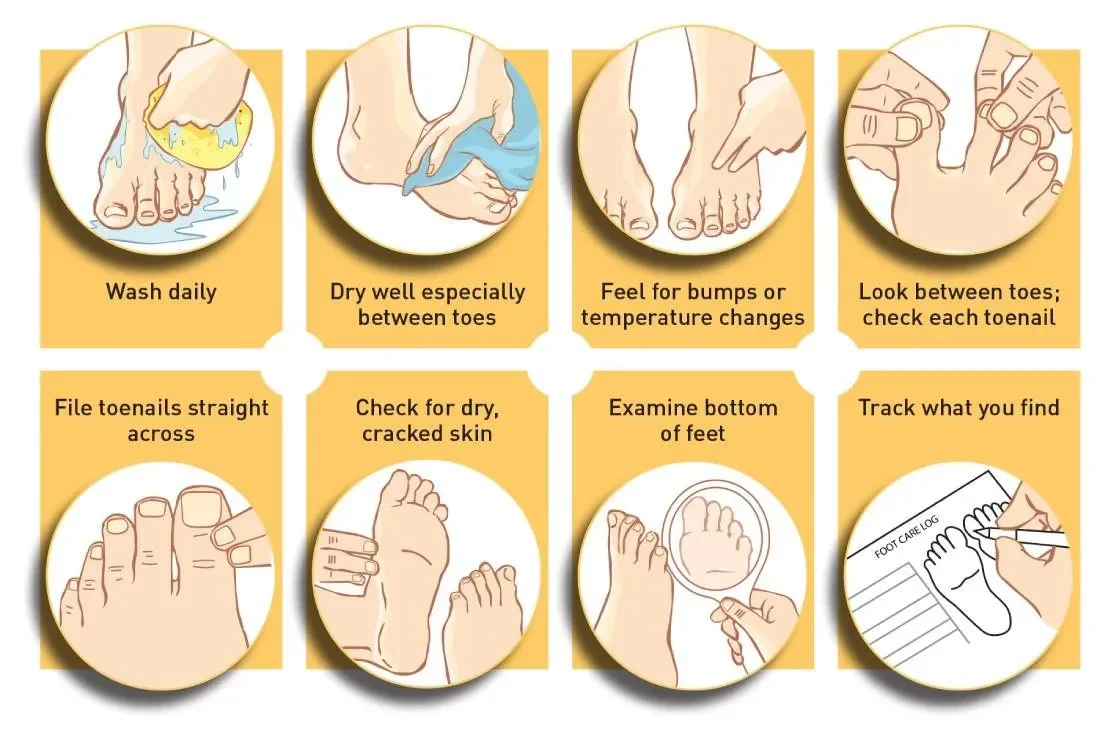 A step-by-step guide for foot care, including washing daily, drying well between toes, feeling for bumps or temperature changes, checking between toes, filing toenails straight across, checking for dry, cracked skin, examining the bottom of the foot, and tracking findings in a foot care log.