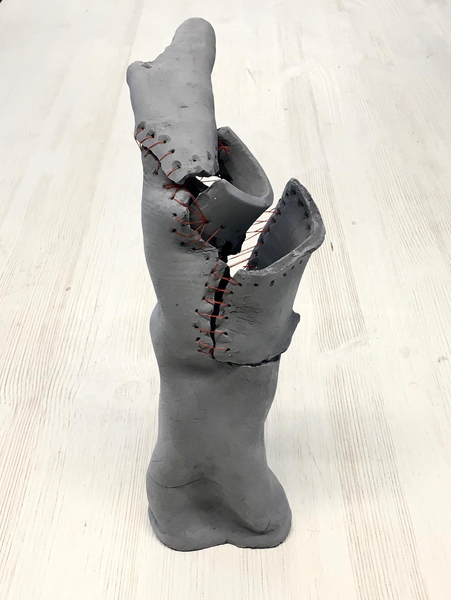 ZGAN | ONDERZOEK | "Gefeliciteerd, u bent gefixt! Zo goed als nieuw." Maar dan begint het pas. Jij moet nog leren leven met deze nieuwe werkelijkheid.