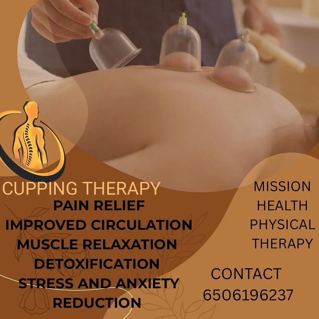 #cupping #massage #physicaltherapist #painmanagement