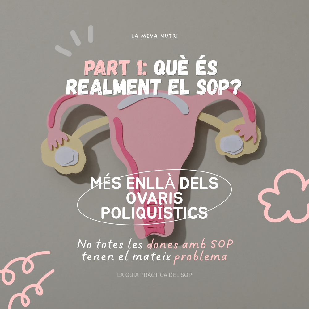 PART 1: Què és el SOP? Més enllà dels ovaris poliquístics