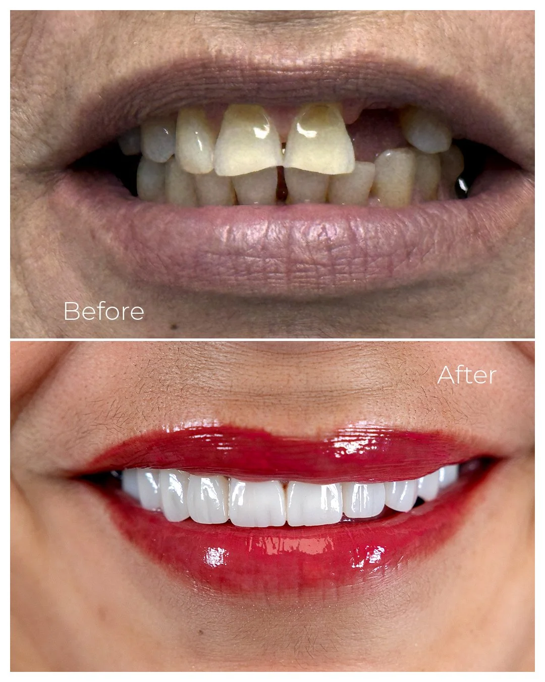 Before and After_06 copy.jpg