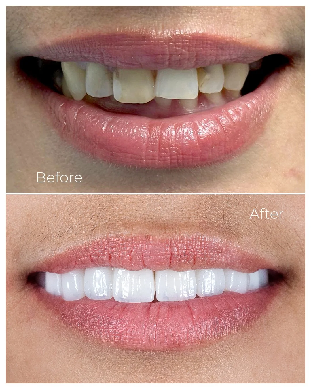 Before and After_05.jpg