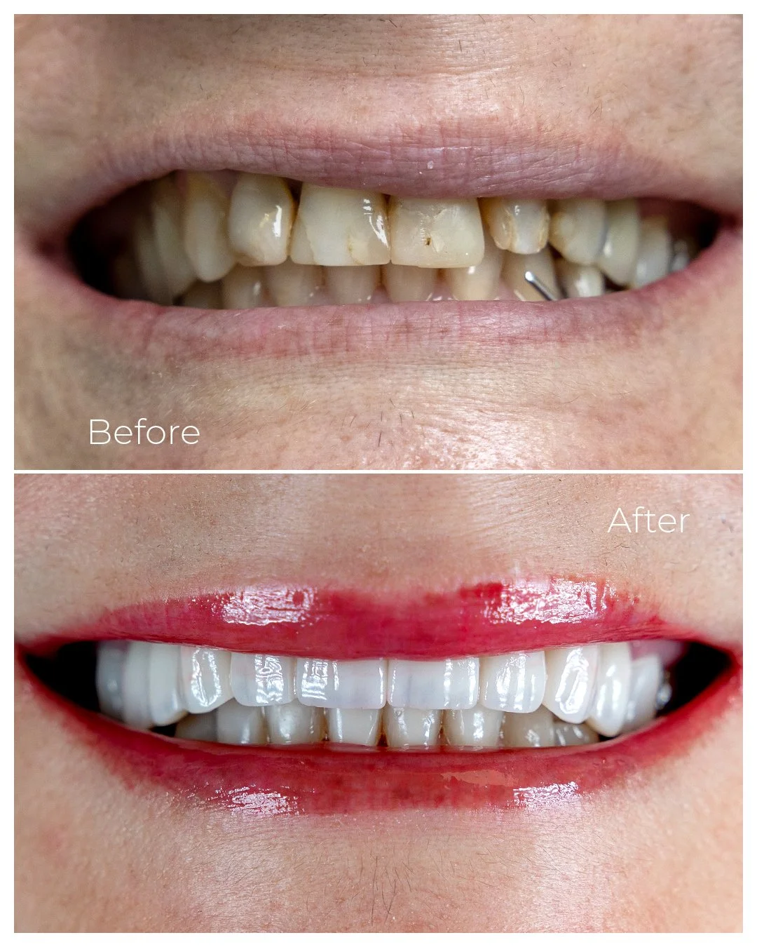 Before and After_2026_2.jpg