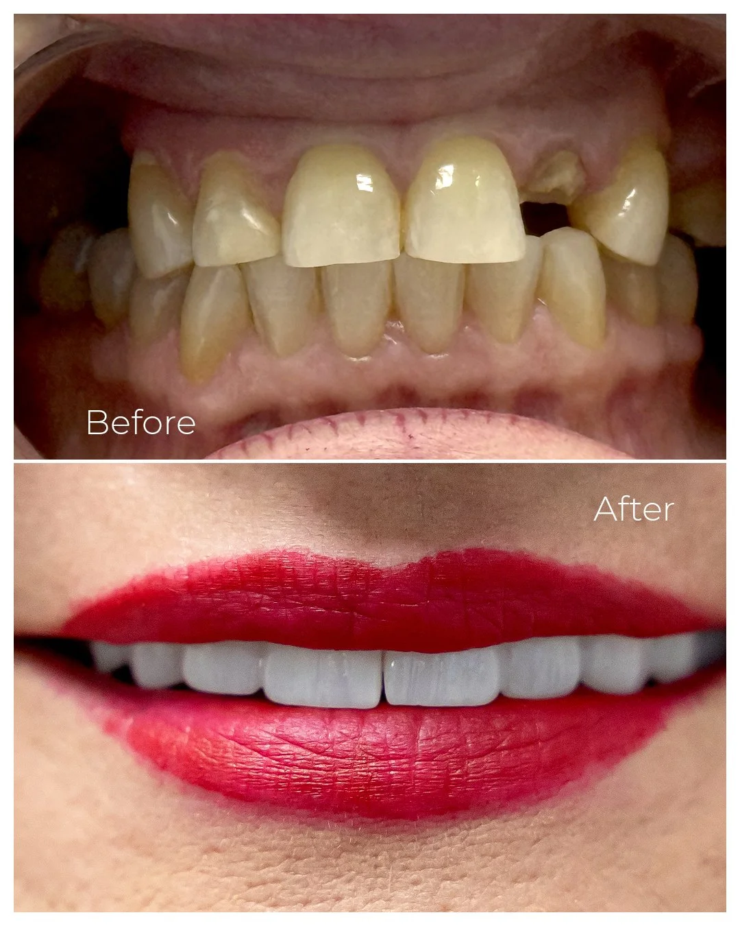 Before and After_2026_9 copy.jpg