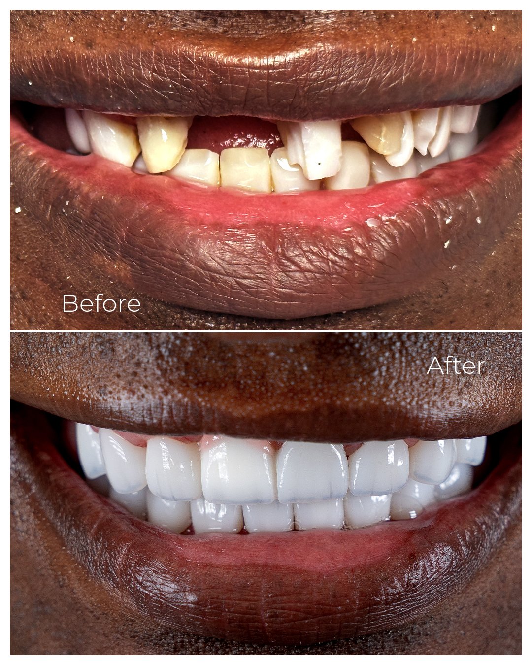 Before and After_2026_4 copy.jpg