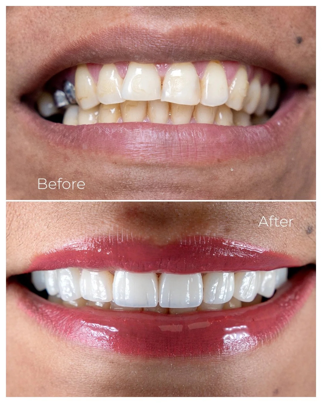 Before and After_2026.jpg